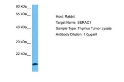 SERAC1 Antibody, Novus Biologicals 100 &mu;L | Buy Online | Novus Biologicals | Fisher Scientific